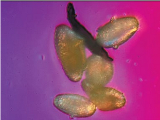 The photographer reveals the true face of the smog under the microscope.jpg