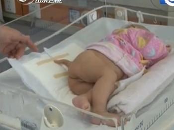 Pay attention to society: The tail of the little girl has been removed.jpg