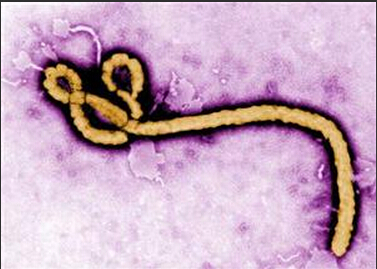 The world should put aside its butcher knife and join forces to fight the Ebola virus.jpg