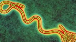The United States unifies state Ebola prevention and control measures.jpg