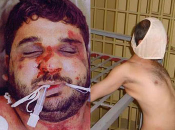 The U.S. Senate reports that CIA prisoners abuse is a historical stain.jpg