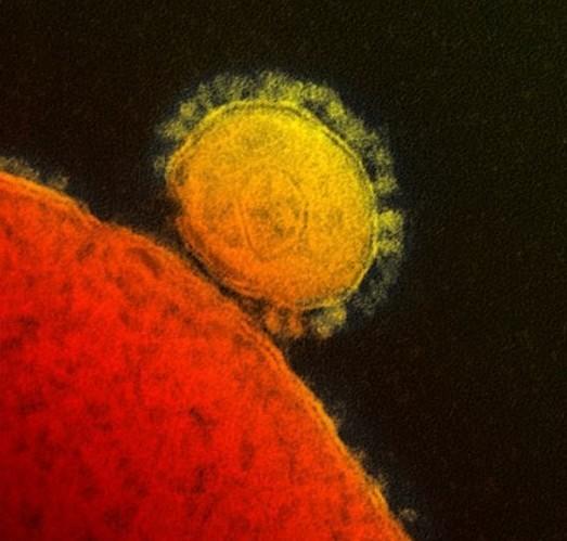 The first suspected case of MERS (Middle East Respiratory Syndrome) appeared in my country.jpg