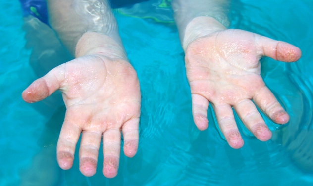 手指和脚趾在水中起皱