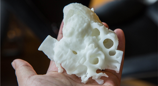 用3D打印技术打印出来的心脏模型.jpg