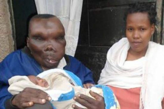 乌干达最丑男子"靠脸吃饭" 已生8个孩子