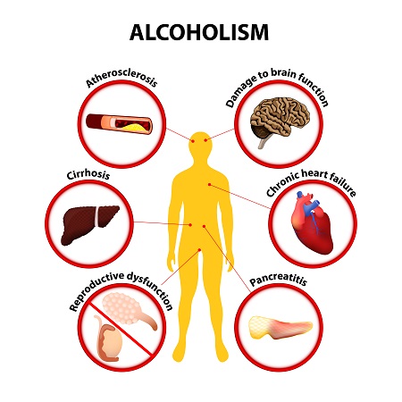 饮酒可致多种慢性疾病