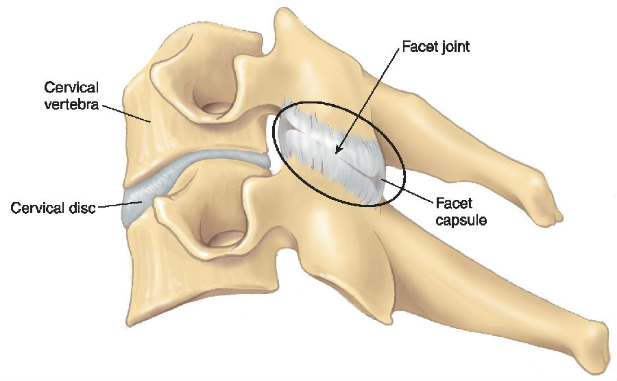 facet-joint.jpg