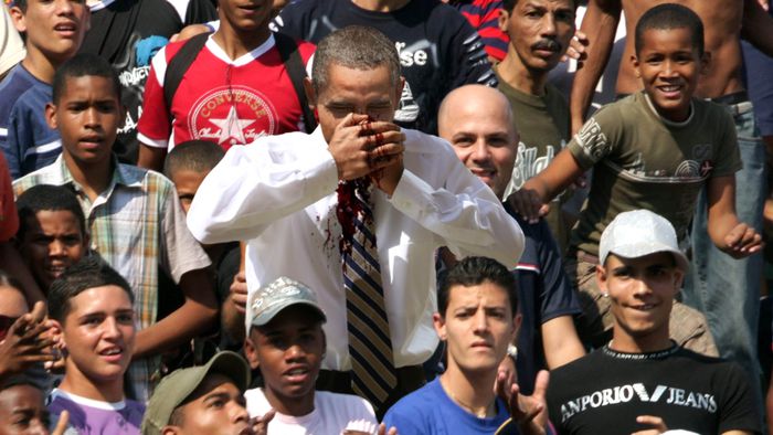 After Obama was hit by an out-of-bounds ball in a baseball game show, the relationship between the United States and Cuba ended.jpg