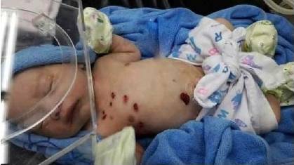 After being stabbed 14 times, the baby was buried alive and survived miraculously! .jpg