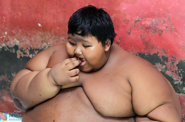 Domination! A 10-year-old Indonesian boy weighed 384 kilograms and became the fattest child in the world! .jpg