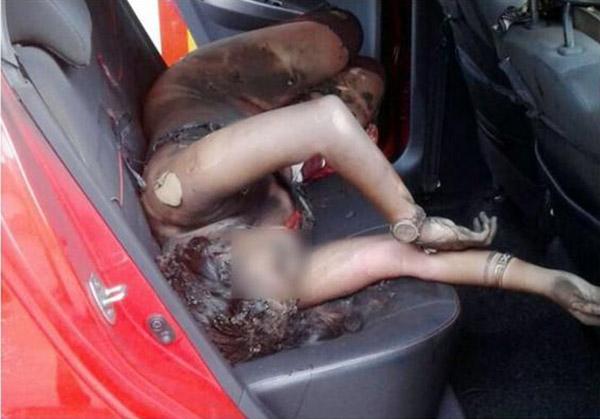 马来西亚女子加油站玩手机闪爆 全身60%灼伤.jpg