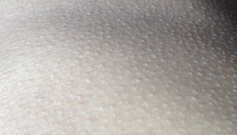 Research tells you why people get goose bumps.jpg