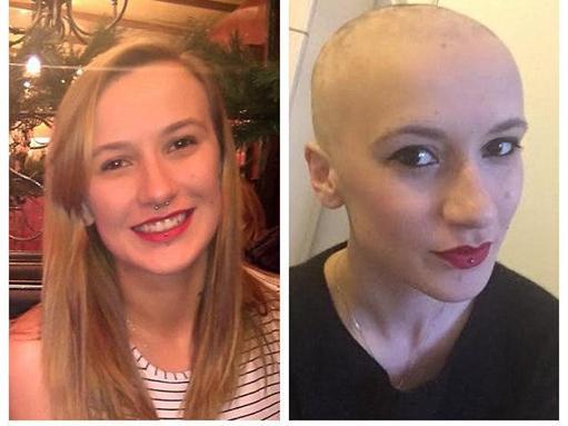 Exam pressure is high. The blonde girl lost her hair in two months and became bald! .jpg