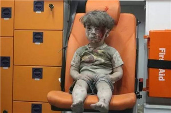 The photo of the boy injured in the Syrian airstrike caught people's hearts.jpg