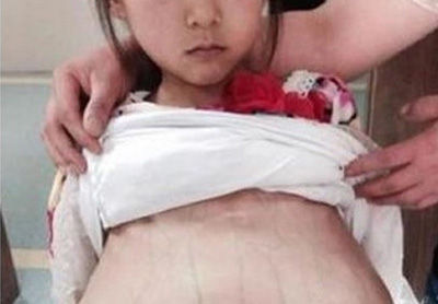 江苏12岁产检女孩系被拐 两名疑犯已被刑拘.jpg