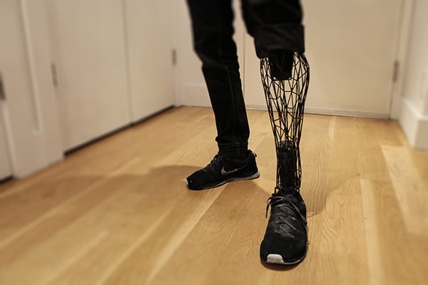 创业公司3D打印假肢