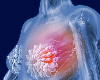新药物有望替代生物治疗治愈乳腺癌
