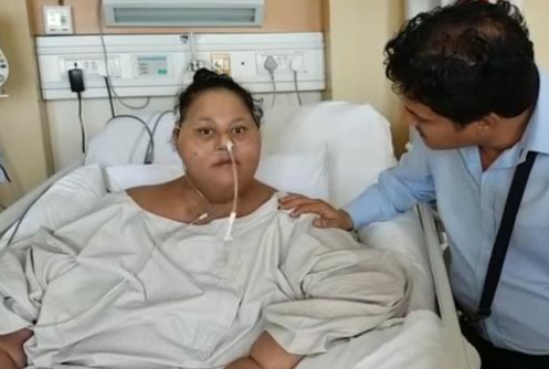 An Egyptian overweight woman lost five hundred catties after surgery.jpg
