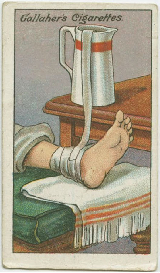 100年前的生活妙招：脚扭伤了，用冷水治疗1.jpg