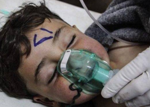 The Swedish Medical Association called the White Helmet a fake video of a poison gas attack on the murder of a child.jpg