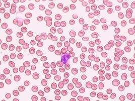 红细胞.jpg
