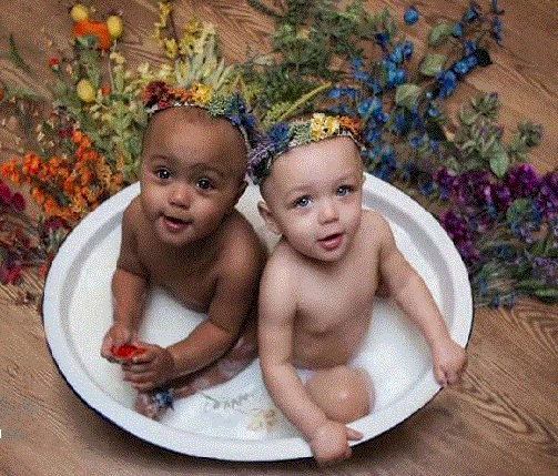Why are these twins born with different skin colors? .jpg