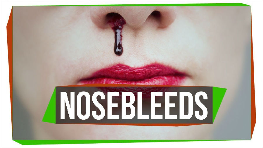 为什么会流鼻血？