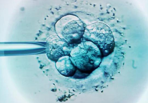 科学家找到决定怀孕成功的关键基因
