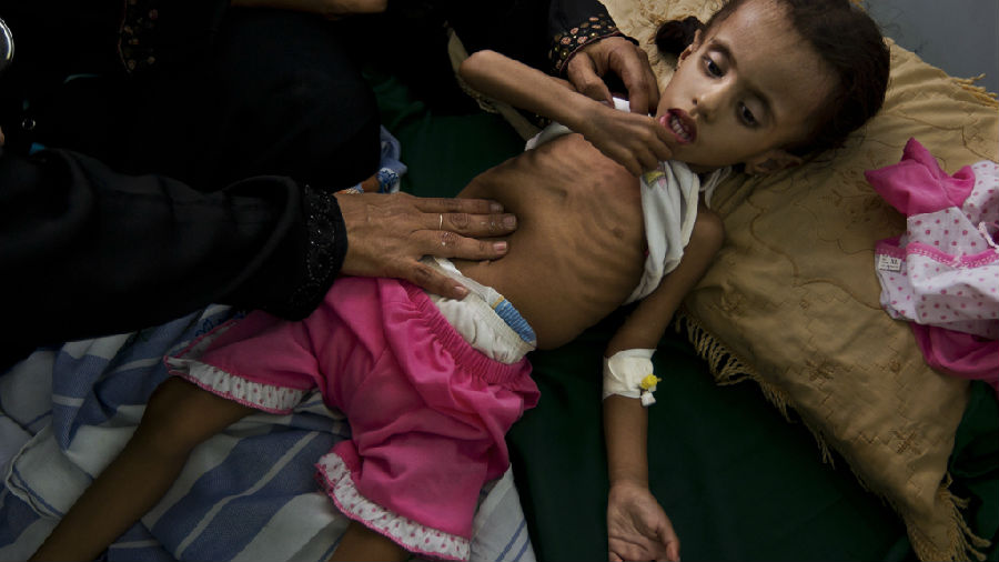 也门正面临本世纪最大饥荒.jpg