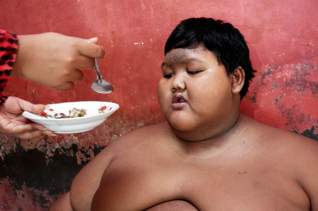曾经世界最胖的孩子减掉了182磅的体重