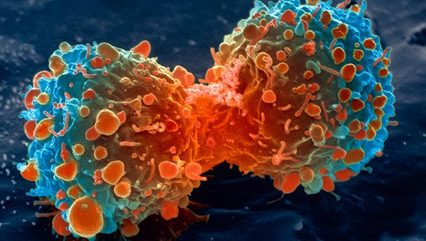 2018年全球新增癌症病例将达到1810万例