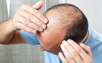 研究发现 人造檀香或能治疗脱发