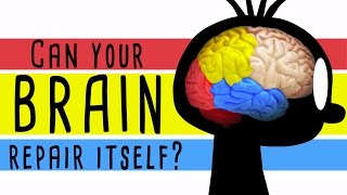 你的大脑能自我修复吗